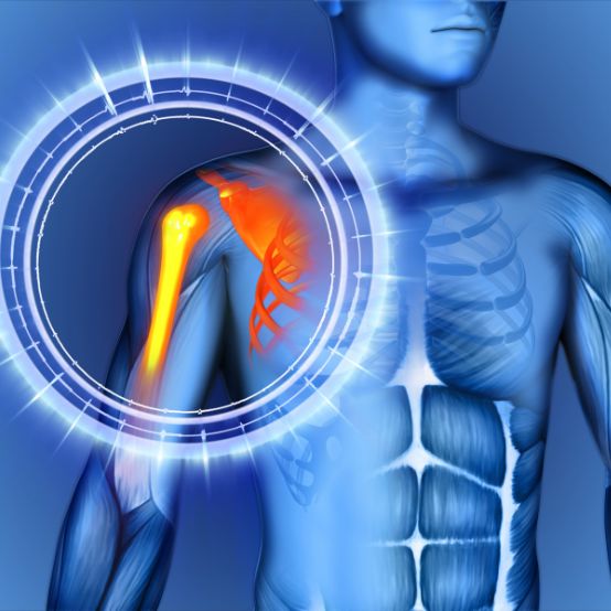 Cirurgia de ombro